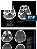 Anatomia Cerebro
