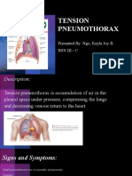 TENSION PNEUMOTHORAX - Presentation