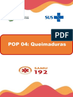 Pop 07 Queimadura