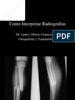 Interpretacion Sistematica RX