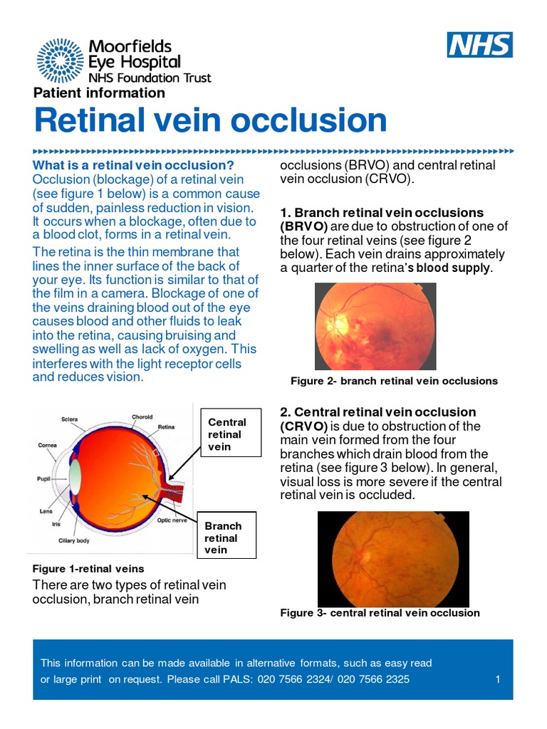 Understanding Retinal Vein Occlusion | PDF | Retina | Medicine