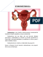 Endometrioza-06 01