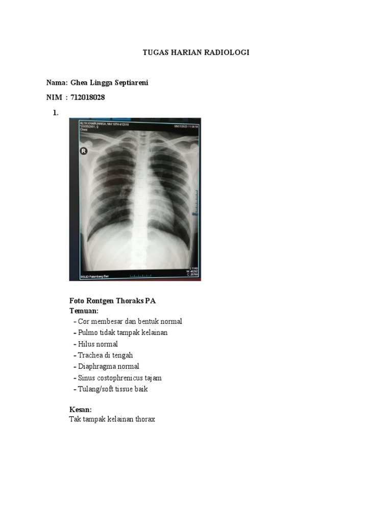 Hasil Rontgen dan Temuan Radiologi | PDF