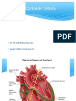 Taquiarritmias