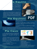 Pie Equino, Varo, y Equinovaro