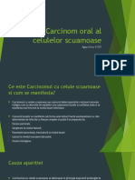 Carcinom Oral Al Celulelor Scuamoase: Agapi Doru S1707