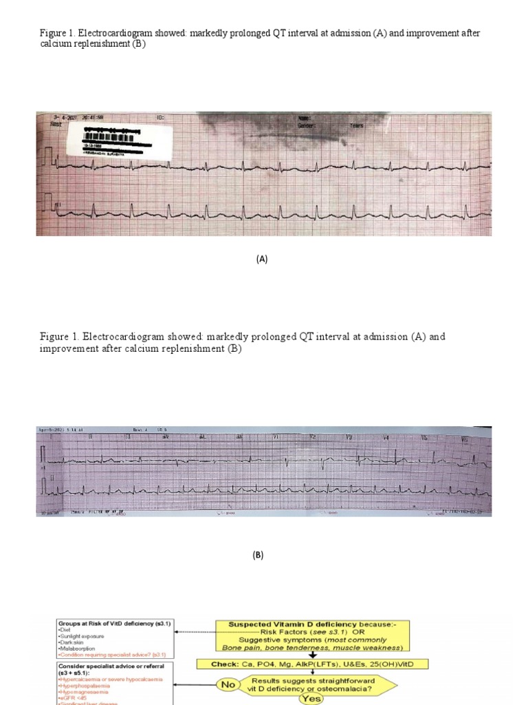 Figure 1. Electrocardiogram Showed Markedly Prolonged QT Interval at