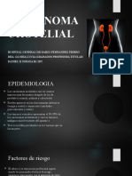 Carcinoma urotelial: epidemiología, factores de riesgo, diagnóstico y tratamiento