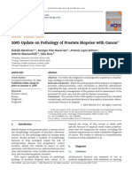 2005 Update On Pathology of Prostate Biopsies With Cancer