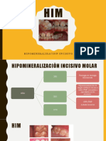 Hipomineralizaciòn Incisivo Molar