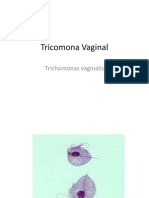 Tricomona Vaginal
