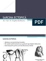 Curs 2 Sarcina Ectopica