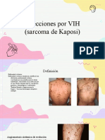 Infecciones Por VIH (Sarcoma de Kaposi)