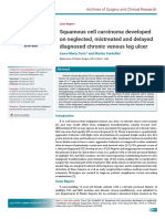 2019 - Squamous Cell Carcinoma Developed On Neglected, Mistreated and Delayed Diagnosed Chronic Venous Leg Ulcer