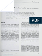 Analysis of Resistance and Retention of Complete Veneer Crown Retainers