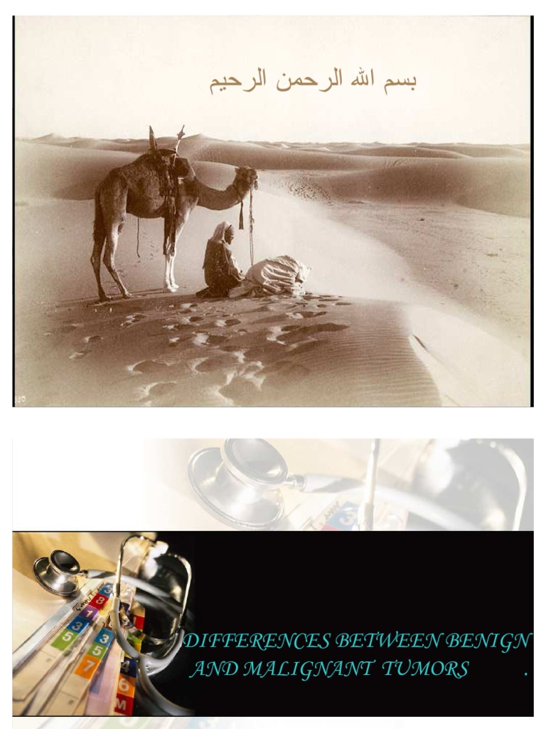 Differences Between Benign and Malignant Tumors | Benign Tumor | Neoplasms