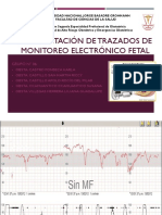 Interpretacion de Trazados Grupo 06