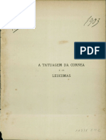 A Tatuagem Da Cornea e Os Leucomas