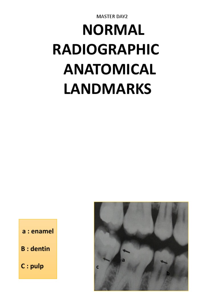 Normal Radiographic Anatomical Landmarks Master Day2 PDF Human