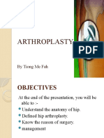 HIP Arthroplasty: by Tiong Me Fah