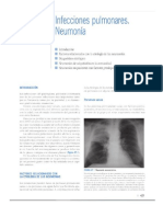 Capítulo 47 INFECCIONES Pulmonares y Neumonia