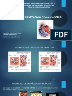 Reparación y reemplazo de válvulas cardíacas