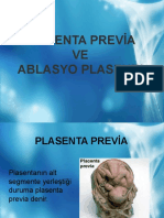 Plasenta Previa, Ablasyo Plasenta2