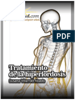 tratamiento-hiprelordosis