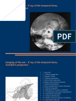 Imaging of The Ear - X Ray of The Temporal Bone, Schuller's Projection