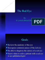 The Red Eye: by DR Jawad Ahmad Khan