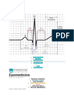 Ecg ekg