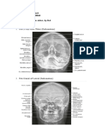 Tugas Radiologi - Desi Ariyanti (16-040) Fixxx