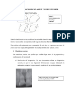 Restauración de Clase Iv Con Resinform