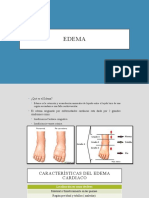 Edema y cianosis: causas y características