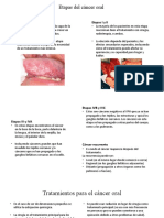 Etapas y Tratamientos Del Cancer Oral