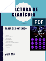 Fractura de Clavícula