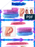 Placenta Previa y Desprendimiento Fetal