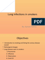 Lung Infections in Smokers: By: Ayman Fatima