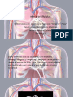 Inima Artificiala