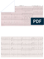 ekg gabung