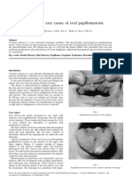 Cowden S Disease A Rare Cause of Oral Sis 2002 Journal of Laryngology and Otology