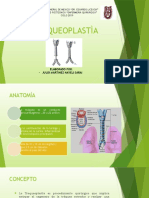 TRAQUEOPLASTIA