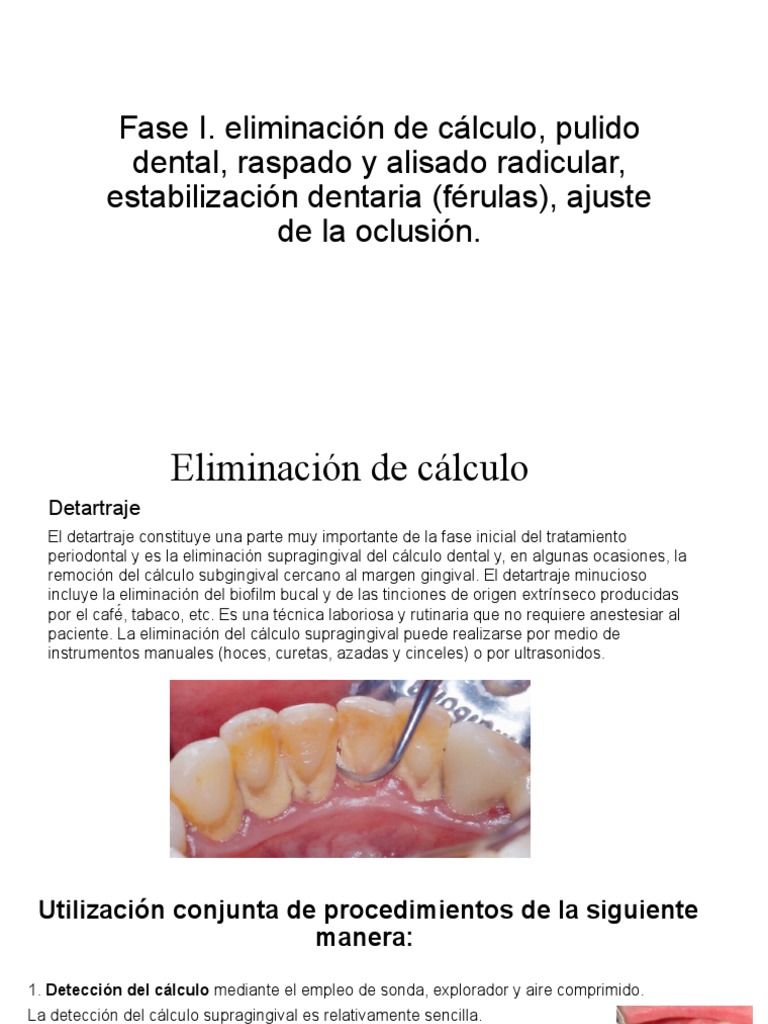 Férula de descarga en Clínica Dental Bejarano - Clínica Dental Bejarano