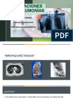 Bronquiectasias, Absceso Pulmonar y Derrame Paraneumónico