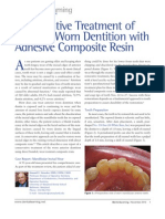 Conservative Treatment of Anterior Worn Dentition With Adhesive Composite Resin