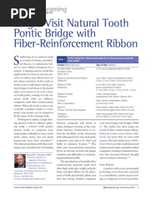 Single Visit Natural Tooth Pontic Bridge With Fiber Reinforcement Ribbon