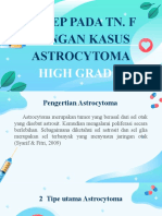 Tumor Astrocytoma