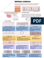 Arritmias Cardiacas