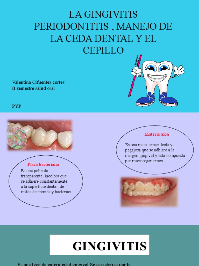 Gingivitis y Periodontitis Yei Pyp PDF Ramas de Odontología Salud