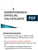 Tumor Odontogenico Epitelial Calcificante